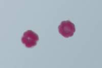 Oursin - embryologie - embryons de 16 cellules x100 